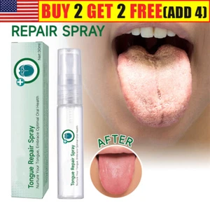 30ml Tongue Repair Spray Reduce Swelling Tongue Relief Treatment Spray - Imagen 1 de 9