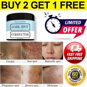 Melasma Spots Dark Spot Corrector Cream 25g For Men & Women ( BUY 2 GET 1 FREE )