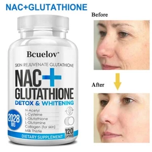 NAC N-Acetyl-Cystein + Glutathion 120 Kapseln 2028mg | Antioxidans Supplement - Bild 1 von 11