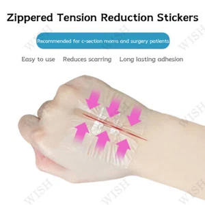 Butterfly Bandaids Wound Closure - Laceration Closure Kit - Zip Stitch Wo - Picture 1 of 12