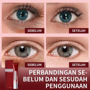 Coffee Anti Wrinkle Eye Cream Moisturizes and Improves Dark X4B9 Circles✨j W2Q0 - Picture 1 of 13