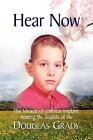 Hear Now: The Miracle of Cochlear Implant: Hearing the Sounds of Life by Douglas
