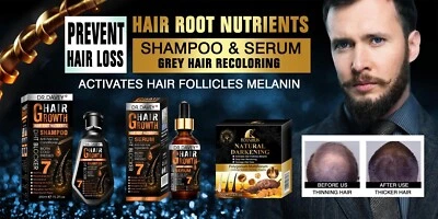 Biotin Hair Shampoo for Thinning Hair Effective hair growth treatment See RESULT - Image 1 of 4