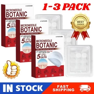 MICRONEEDLE BOTANIC Skin Tag & Acne Patch 9 Stück Hautanhängsel Entferner Pflaster - Hot℗ - Bild 1 von 24
