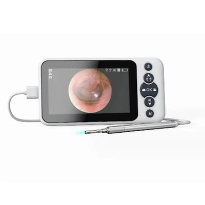 Otoskop-Ohrkamera, Intelligenter Ohrenreiniger, Visueller OhrlöFfel mit Kam4153 - Bild 1 von 4