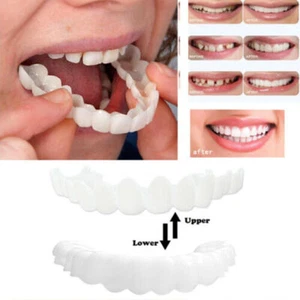 Impiallacciature a scatto Visiera dentale cosmetica Protesi Comfort Denti finti - Foto 1 di 14