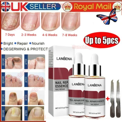 5X LANBENA Nail Repair Essence Remove Onychomycosis Serum Fungal Nail Treatment