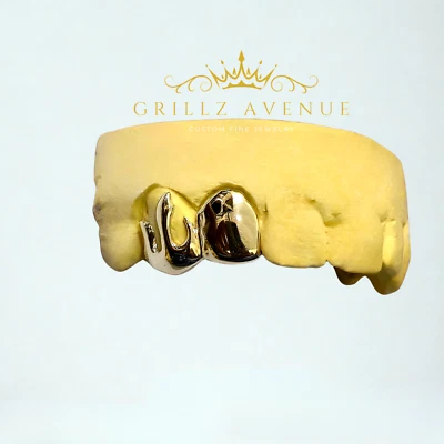 Parrilla de ajuste personalizado 2 piezas cara abierta y corazón (plata de ley 925/k/kit de molde gratis) Foto 1 de 3