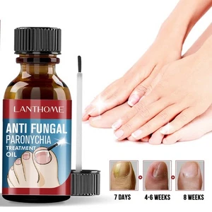 10ML Fungal Nail Renewal Treatment Toenail and Nail Repair Fungus Remover - Picture 1 of 7