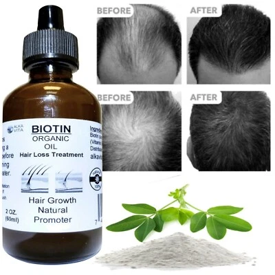 Hair Loss Biotin Oil  Silica Peanut  Oil Hair Growth Promoter Thickener ALKAVITA - Image 1 of 4