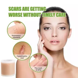 1x Scar Patch Silicone Scar Paste Effectively Remove Washable Scar and M9M0 - Picture 1 of 18