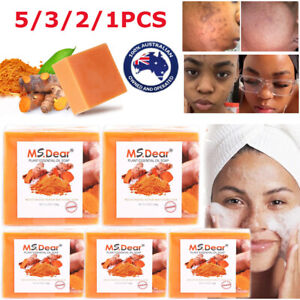 6/3PACK Turmeric Soap,Anti Acne Skin Whitening Bleaching Face&Body Dark Spots