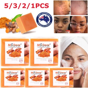 6/3PACK Turmeric Soap,Anti Acne Skin Whitening Bleaching Face&Body Dark Spots - Picture 1 of 22