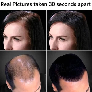 Looks21 Capelli in 30 Secondi (Marrone Scuro, 3 Grammi/0,11 Oz)|Correttore Perdita Capelli - Foto 1 di 21