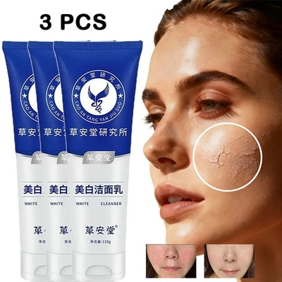 Limpiador facial blanqueador removedor de pecas limpiador hidratante de la piel limpieza Foto 1 de 4