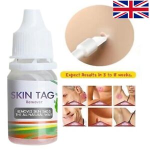 PRO Skin Tag Remover Treatment Mole Solution Skin Tag -EFFORTLESS ELIMINATION