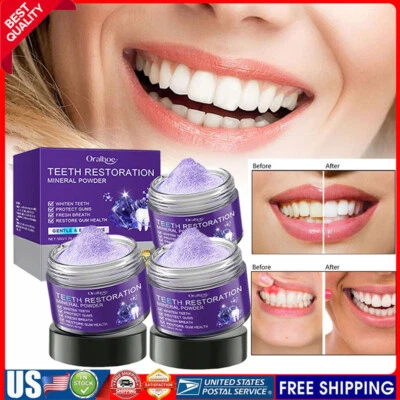5X Dental restoration mineral powder, mineral tooth powder, teeth whitening US - Image 1 of 4
