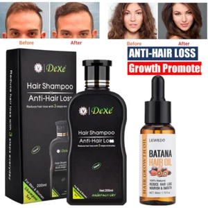 Hair Growth Shampoo, Anti-Hair Loss Shampoo Herbal Hair Growth Treatment - Picture 1 of 21