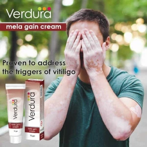 Mela Gain Cream 75gm Vitiligo Treatment | Natural Skin Repigmentation Therapy
