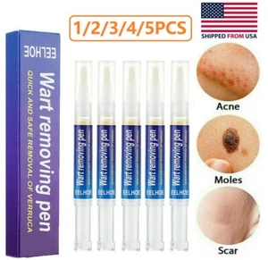 1-5PCS 12 Hours Wart Remover Pen Skin Tag Mole Remover Eliminate Foot Corn Warts - Picture 1 of 12