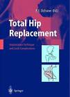 Total Hip Replacement - 9783540438762