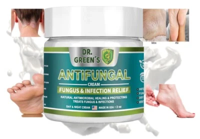 DRGREENS ANTIFUNGAL Antifungal Cream Natural Hair, Skin & Nail All in One Intensive Head to Toe 2 Oz