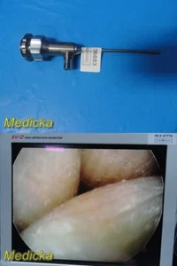 Smith & Nephew DYONICS 3896 ECTRA II starres Videoendoskop (4 mm x 30°) ~ 36883 - Bild 1 von 23