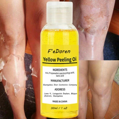 Super Strength yellow Peeling Oil Lightening Exfoliating Dark skin for body - Image 1 of 4