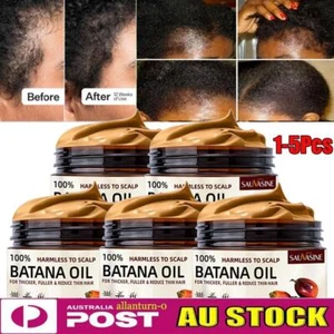 Natural Batana Oil Cream For Hair Growth Healthier Thicker Fuller Anti Hair Loss - Picture 1 of 17