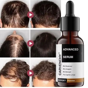 Bare Anatomy Advanced Hair Growth Serum 30 ml P0U8 - Picture 1 of 11