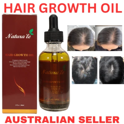 Aceite de crecimiento del cabello menta para todo tipo de cabello - 60 ml Foto 1 de 4