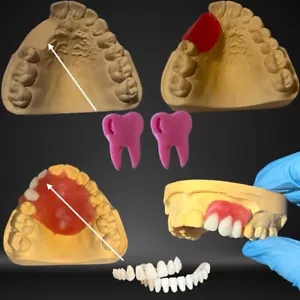 DIY Model Repair Kit, Denture, Dentures, Prostheses, Dental Base, Dentures - Picture 1 of 11