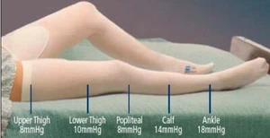 T.E.D. Thigh Length Anti-Embolism Stockings X-Large Long EA of 1 - Picture 1 of 1