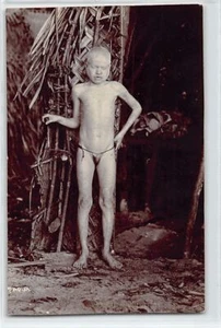 PAPUA NEW GUINEA - Papuan Albino child, the only known - REAL PHOTO - Picture 1 of 2