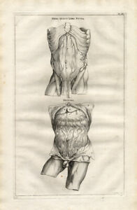 4 Antique Medical Prints-BODY-INTESTINES-Vesalius-1725