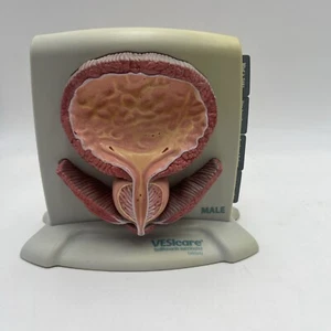 VESIcare Bladder Incontinence Prostate Male Female Anatomical Pathology Model - Picture 1 of 8