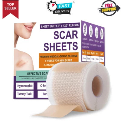Silicone Scar Sheets,Silicone Scar Tape,Silicone Sheets For Scars - 1.6"X 120"in - Image 1 of 4