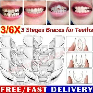 6X Aparatos dentales adultos Retenedor Ortodoncia Corrección dental Brace dental - Imagen 1 de 14
