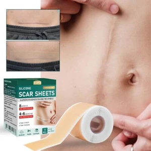 Beauty Scar Removal Silicone Gel Self-Adhesive Silicone Gel Tape AU - Picture 1 of 11