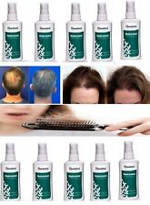 10 X HIMALAYA HAIRZONE SOLUTION OIL 60ML PREVENTS HAIR FALL,PROMOTES HAIR GROWTH