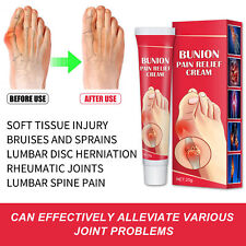 3x 0.7oz Bunion Relief Cream Herbal Extract Toe Swelling Relief Cream BX5
