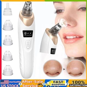 Blackhead Remover Pore Vacuum,Facial Pore Cleaner-5 Suction Power,5 Probes,USB✅ - Picture 1 of 11