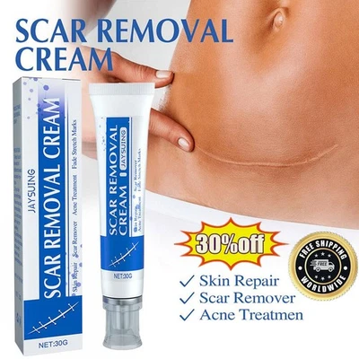 30g SCAR REMOVAL CREAM Skin Repair Scar Remover Acne Treatment Fade Stretch Mark - Image 1 of 4