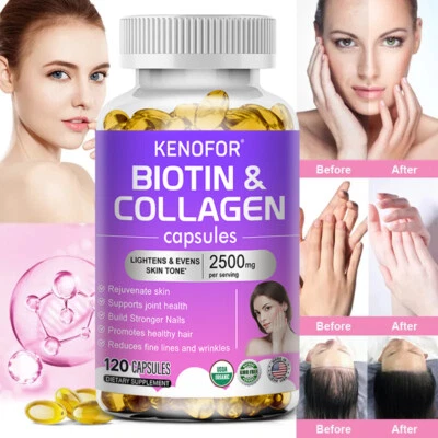 KENOFOR Kollagen + Biotin - Premium Hydrolysiert Collagen - Anti-Aging & Gelenke