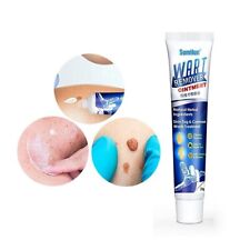 Sumifun Warts Remover Cream Body Skin Face Warts Natural Treatment Pack Of 20g