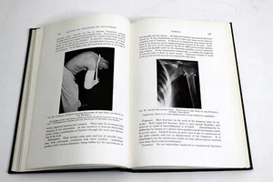FRACTURES AND DISLOCATIONS FOR PRACTITIONERS by E Geckeler 1940 Vintage Medical - Picture 1 of 4