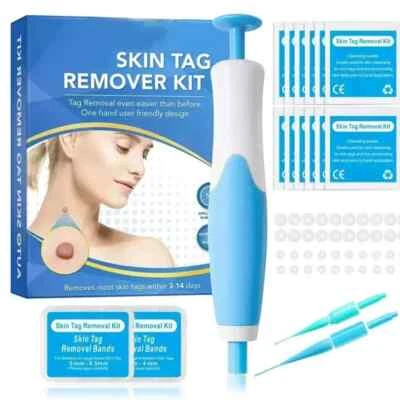 Natural Painless Auto SKIN TAG Removal Kit Skin Tag Micro Bands Remover Device