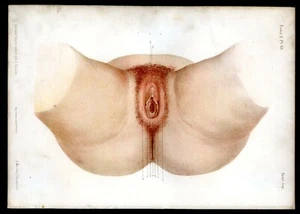 Anatomie, Medizin Dammregion des Weibchens..2 antike Chromolithographien ... 1867 - Bild 1 von 4