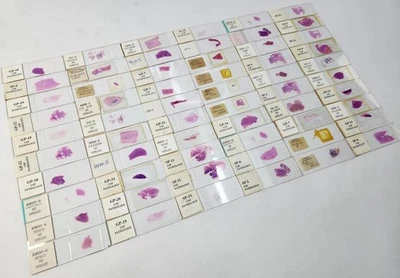 Lot Of 50 Vintage University Prepared Pathology Microscope Slides - Slides Only - Image 1 of 4
