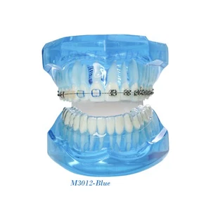 Modelo de ortodoncia tipodoncia dental con retenedor cerámico metal soporte autobloqueante - Imagen 1 de 13
